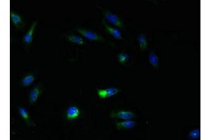 Immunofluorescent analysis of Hela cells using ABIN7144817 at dilution of 1:100 and Alexa Fluor 488-congugated AffiniPure Goat Anti-Rabbit IgG(H+L) (ATL3 anticorps  (AA 1-187))