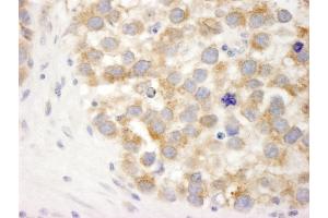 Immunohistochemistry (IHC) image for anti-DEAD (Asp-Glu-Ala-Asp) Box Polypeptide 3, X-Linked (DDX3X) (AA 1-50) antibody (ABIN7448520) (DDX3X anticorps  (AA 1-50))