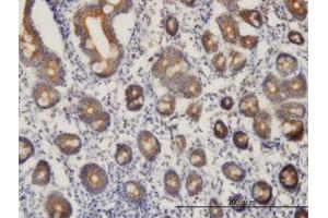 Image no. 1 for anti-Chromosome 21 Open Reading Frame 33 (C21orf33) (AA 188-269) antibody (ABIN599034) (C21orf33 anticorps  (AA 188-269))
