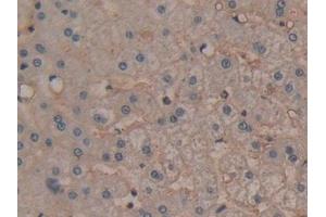 Detection of ANXA6 in Human Liver Tissue using Polyclonal Antibody to Annexin A6 (ANXA6)