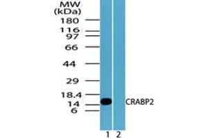 Image no. 2 for anti-Cellular Retinoic Acid Binding Protein 2 (CRABP2) (AA 75-125) antibody (ABIN960117) (CRABP2 anticorps  (AA 75-125))