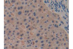 DAB staining on IHC-P; Samples: Human Liver Tissue