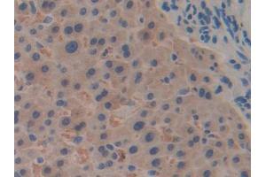 DAB staining on IHC-P; Samples: Human Liver Tissue (RPN1 anticorps  (AA 180-307))