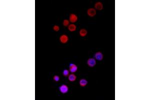 Immunofluorescence analysis of Neuro-2a cells using TRPC5 Rabbit pAb (ABIN6128835, ABIN6149578, ABIN6149579 and ABIN6214219) at dilution of 1:150 (40x lens). (TRPC5 anticorps  (AA 764-973))