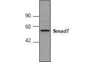 Image no. 1 for anti-SMAD, Mothers Against DPP Homolog 7 (SMAD7) antibody (ABIN127302) (SMAD7 anticorps)