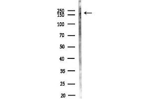 Western blot analysis of lysates from Mouse testis, using ESA Antibody at 1/1000 dilution.