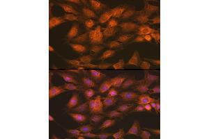 Immunofluorescence analysis of C6 cells using IKKγ Rabbit pAb (ABIN3021150, ABIN3021151, ABIN3021152 and ABIN6214025) at dilution of 1:100 (40x lens).