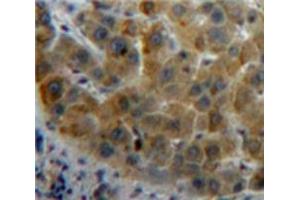 Used in DAB staining on fromalin fixed paraffin-embedded Liver tissue