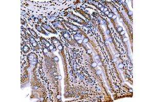 IHC analysis of Histone H1. (Histone H1 anticorps  (AA 20-159))