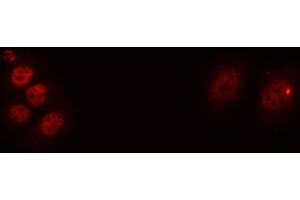 ABIN6276654 staining A549 cells by ICC/IF. (BDNF anticorps  (Internal Region))