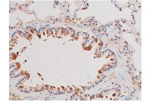 ABIN6267487 at 1/200 staining Rat lung tissue sections by IHC-P.