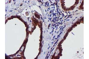 Immunohistochemical staining of paraffin-embedded Human breast tissue using anti-EPN2 mouse monoclonal antibody. (Epsin 2 anticorps)