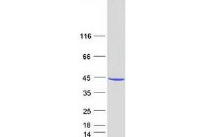 Validation with Western Blot