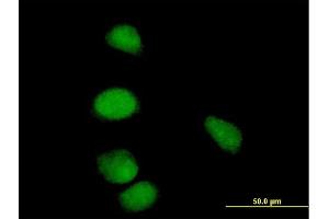 Immunofluorescence of purified MaxPab antibody to CCNE1 on HeLa cell.