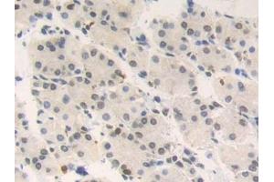 Detection of HMGN2 in Human Stomach Tissue using Polyclonal Antibody to High Mobility Group Nucleosome Binding Domain Containing Protein 2 (HMGN2)