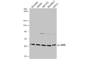 WB Image Various whole cell extracts (30 μg) were separated by 7.