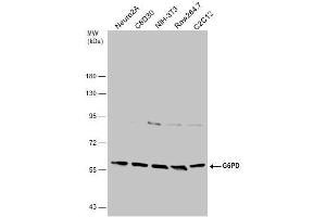 WB Image Various whole cell extracts (30 μg) were separated by 7. (Glucose-6-Phosphate Dehydrogenase anticorps)