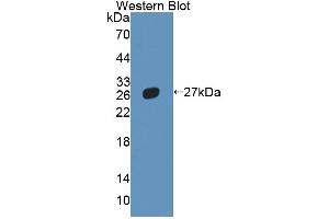 Western blot analysis of the recombinant protein. (NR5A2 + LRH1 anticorps  (AA 1-205))