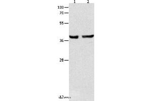 Western blot analysis of Mouse esophagus and human cervical cancer tissue , using SERPINB5 Polyclonal Antibody at dilution of 1:1000 (SERPINB5 anticorps)