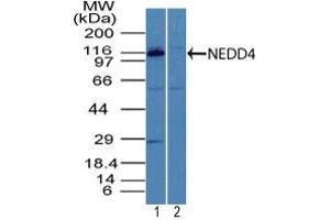 Image no. 1 for anti-Neural Precursor Cell Expressed, Developmentally Down-Regulated 4, E3 Ubiquitin Protein Ligase (NEDD4) (AA 200-250) antibody (ABIN960274) (NEDD4 anticorps  (AA 200-250))