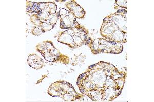 Immunohistochemical analysis using ABIN6140687
