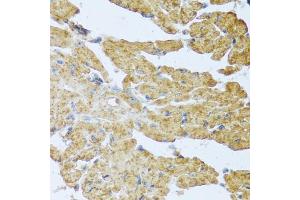 Immunohistochemistry of paraffin-embedded mouse heart using IL20 antibody (ABIN5973987) at dilution of 1/100 (40x lens). (IL-20 anticorps)