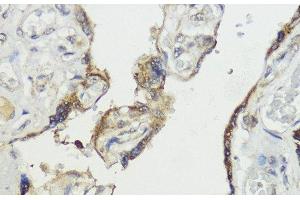 Immunohistochemistry of paraffin-embedded Human placenta using HACE1 Polyclonal Antibody at dilution of 1:100 (40x lens).