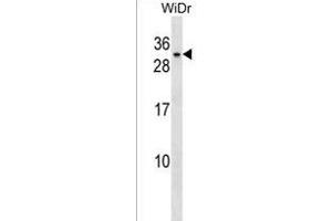 BHLHA9 Antibody (Center) (ABIN1538494 and ABIN2850208) western blot analysis in WiDr cell line lysates (35 μg/lane). (BHLHA9 anticorps  (AA 57-83))