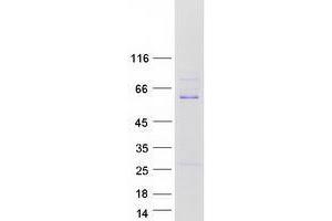 Validation with Western Blot