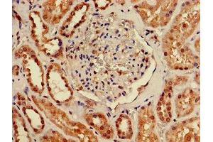 Immunohistochemistry of paraffin-embedded human kidney tissue using ABIN7173087 at dilution of 1:100 (TMEM161B anticorps  (AA 1-487))