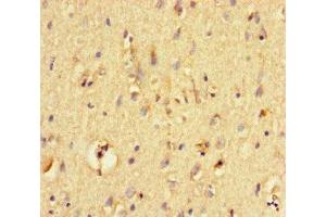 Immunohistochemistry of paraffin-embedded human brain tissue using ABIN7161472 at dilution of 1:100 (Neurotrypsin anticorps  (AA 631-874))