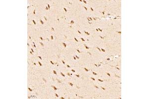 Immunohistochemistry of paraffin embedded rat brain using RBAK (ABIN7075383) at dilution of 1:1000 (400x lens) (RBAK anticorps)
