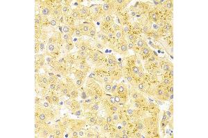 Immunohistochemistry (IHC) image for anti-Wilms Tumor 1 (WT1) (AA 1-302) antibody (ABIN6215537) (WT1 anticorps  (AA 1-302))