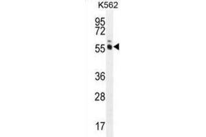 Western Blotting (WB) image for anti-MAGE-Like 2 (MAGEL2) antibody (ABIN3002537) (MAGE-Like 2 anticorps)