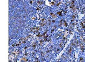 IHC analysis of TXNDC5 using anti-TXNDC5 antibody (ABIN7599699). (TXNDC5 anticorps  (AA 109-403))