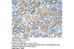 Rabbit Anti-RPL8 Antibody  Paraffin Embedded Tissue: Human Kidney Cellular Data: Epithelial cells of renal tubule Antibody Concentration: 4. (RPL8 anticorps  (C-Term))