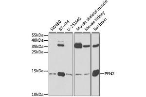 Western blot analysis of extracts of various cell lines, using PFN2 antibody. (PFN2 anticorps)