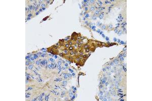 Immunohistochemistry of paraffin-embedded rat testis using PGRMC1 antibody (ABIN5973273) at dilution of 1/100 (40x lens). (PGRMC1 anticorps)