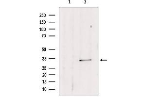 Western blot analysis of extracts from mouse lung, using SULT1E1 antibody. (SULT1E1 anticorps  (Internal Region))