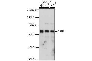 Western blot analysis of extracts of various cell lines, using GRB7 antibody. (GRB7 anticorps)
