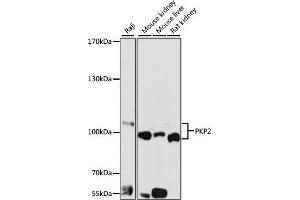 Western blot analysis of extracts of various cell lines, using PKP2 antibody (ABIN6128554, ABIN6145717, ABIN6145718 and ABIN6221177) at 1:1000 dilution.