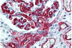 Human Kidney, Endothelium (formalin-fixed, paraffin-embedded) stained with CD34 antibody ABIN305772 at 5 ug/ml followed by biotinylated anti-mouse IgG secondary antibody ABIN481714, alkaline phosphatase-streptavidin and chromogen. (CD34 anticorps)