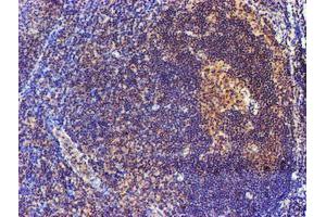 Image no. 3 for anti-Spermine Synthase, SMS (SMS) antibody (ABIN1501093)