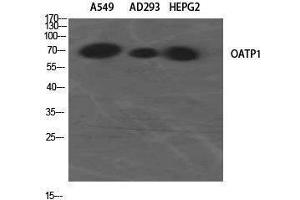 Western Blotting (WB) image for anti-Solute Carrier Organic Anion Transporter Family, Member 1A2 (SLCO1A2) (Internal Region) antibody (ABIN3185985) (SLCO1A2 anticorps  (Internal Region))