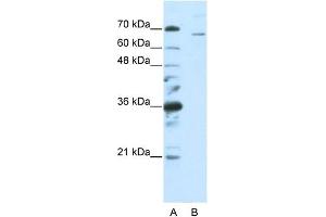 WB Suggested Anti-SF1  Antibody Titration: 0.