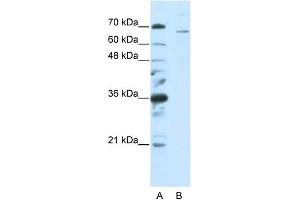 WB Suggested Anti-SF1  Antibody Titration: 0. (Splicing Factor 1 anticorps  (C-Term))
