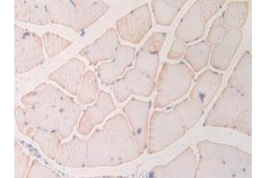 DAB staining on IHC-P; Samples: Rat Skeletal muscle Tissue (MYL6B anticorps  (AA 6-137))