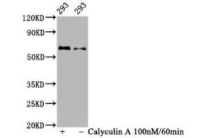 Western Blot Positive WB detected in 293 whole cell lysate(treated with Calyculin A or not) All lanes Phospho-AKT1 antibody at 1. (Recombinant AKT1 anticorps  (pSer473))