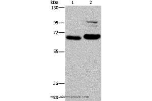 Western blot analysis of K562 and NIH/3T3 cell, using OS9 Polyclonal Antibody at dilution of 1:200 (OS9 anticorps)