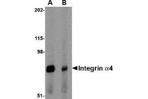 Western blot analysis of Integrin alpha 4 in rat spleen tissue lysate with Integrin alpha 4 antibody at 1 μg/ml in (A) the absence and (B) the presence of blocking peptide. (ITGA4 anticorps  (Center))